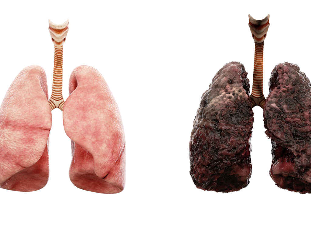 Les Bienfaits de l’Arrêt du Tabac sur la Respiration et la Capacité Pulmonaire