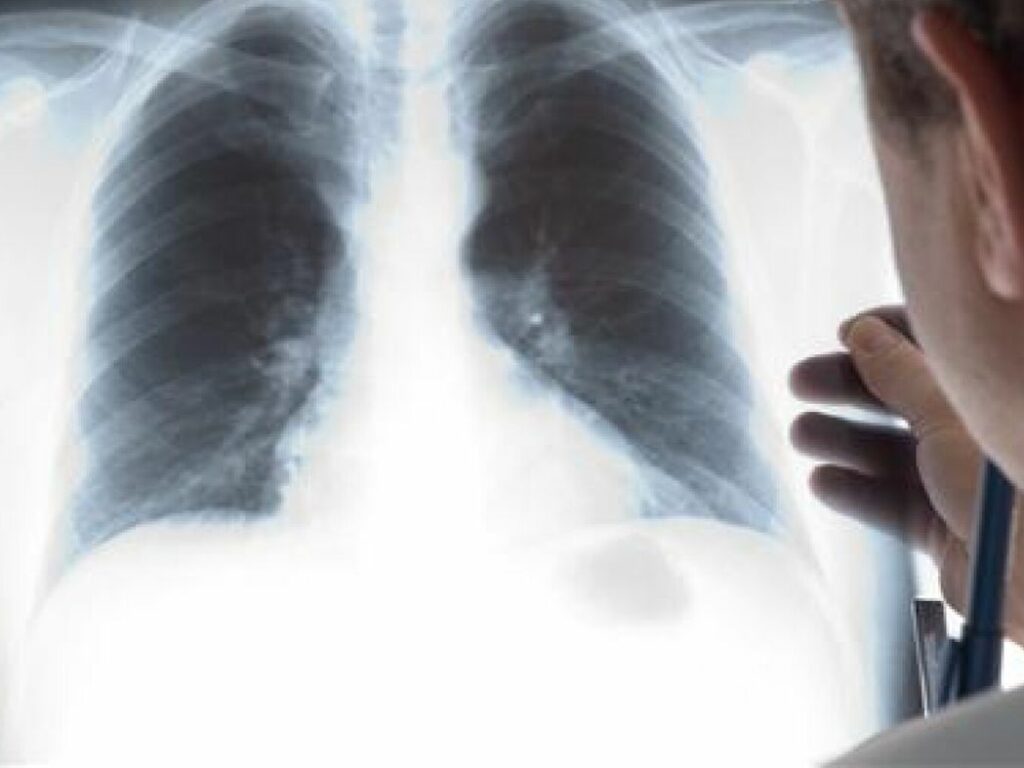 Le nettoyage du corps après l’arrêt du tabac : mythe ou réalité ?